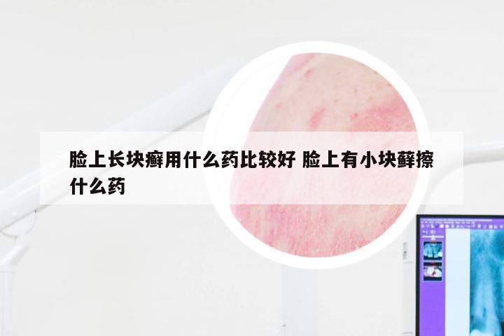 脸上长块癣用什么药比较好 脸上有小块藓擦什么药