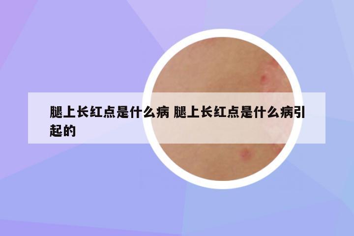 腿上长红点是什么病 腿上长红点是什么病引起的