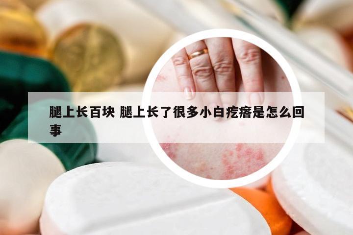 腿上长百块 腿上长了很多小白疙瘩是怎么回事