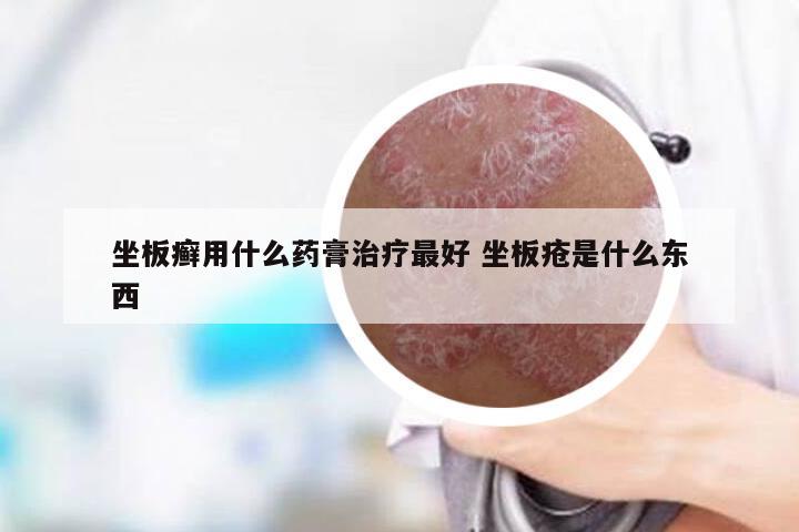 坐板癣用什么药膏治疗最好 坐板疮是什么东西