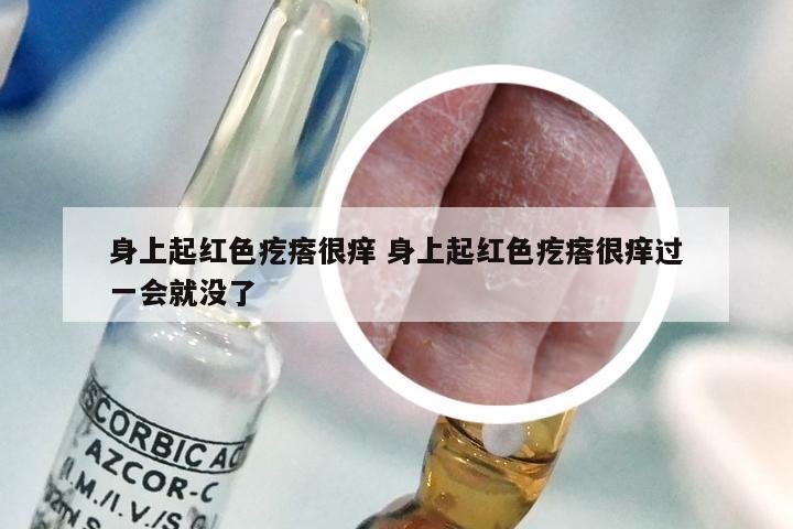 身上起红色疙瘩很痒 身上起红色疙瘩很痒过一会就没了