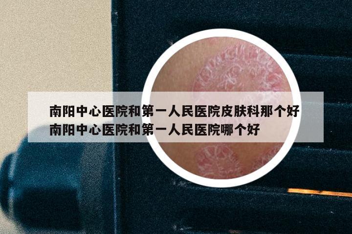 南阳中心医院和第一人民医院皮肤科那个好 南阳中心医院和第一人民医院哪个好