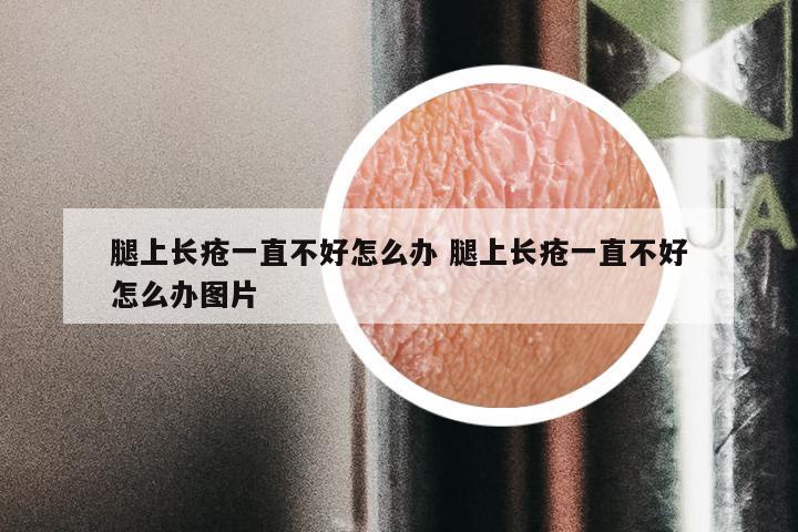 腿上长疮一直不好怎么办 腿上长疮一直不好怎么办图片