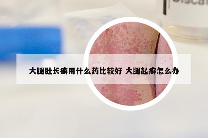 大腿肚长癣用什么药比较好 大腿起癣怎么办