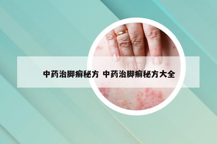 中药治脚癣秘方 中药治脚癣秘方大全