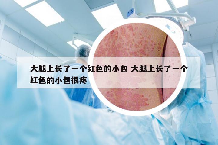 大腿上长了一个红色的小包 大腿上长了一个红色的小包很疼