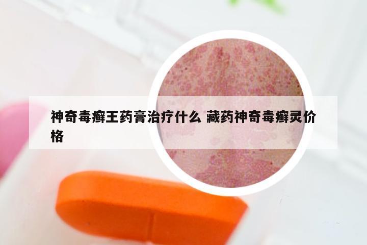 神奇毒癣王药膏治疗什么 藏药神奇毒癣灵价格