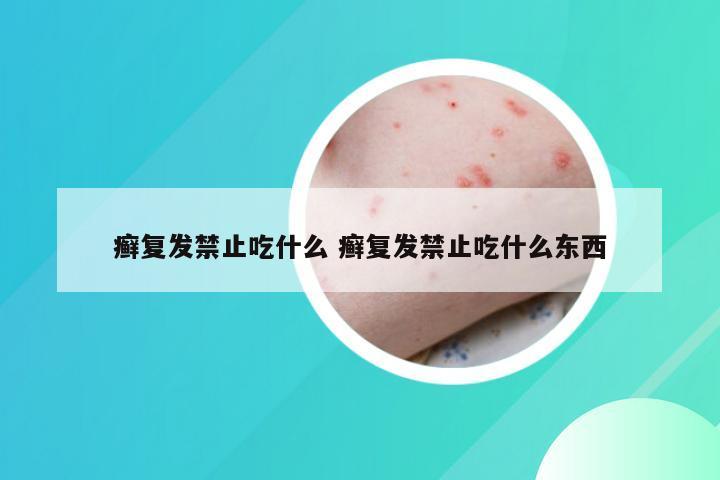 癣复发禁止吃什么 癣复发禁止吃什么东西