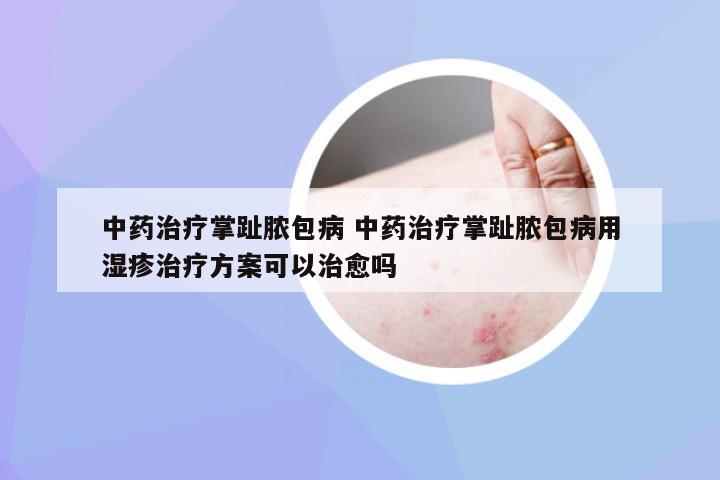 中药治疗掌趾脓包病 中药治疗掌趾脓包病用湿疹治疗方案可以治愈吗