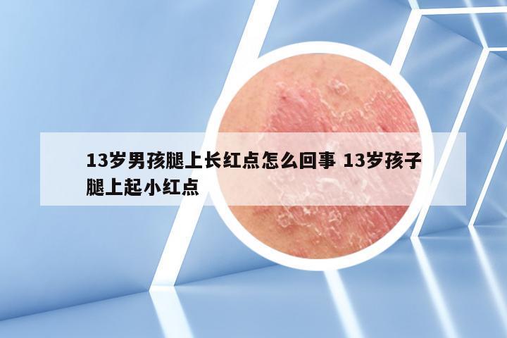 13岁男孩腿上长红点怎么回事 13岁孩子腿上起小红点