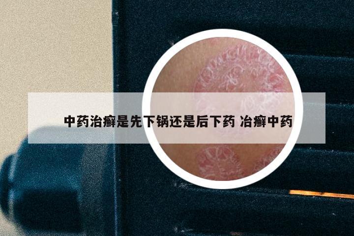 中药治癣是先下锅还是后下药 冶癣中药