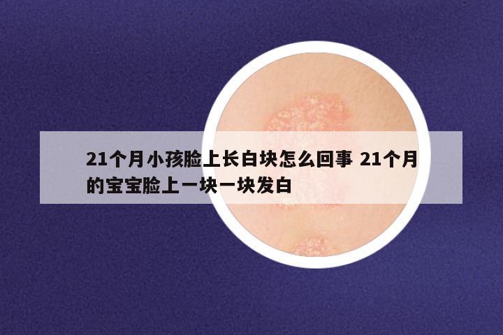 21个月小孩脸上长白块怎么回事 21个月的宝宝脸上一块一块发白