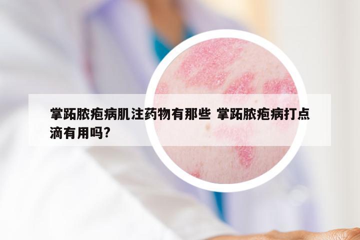 掌跖脓疱病肌注药物有那些 掌跖脓疱病打点滴有用吗?