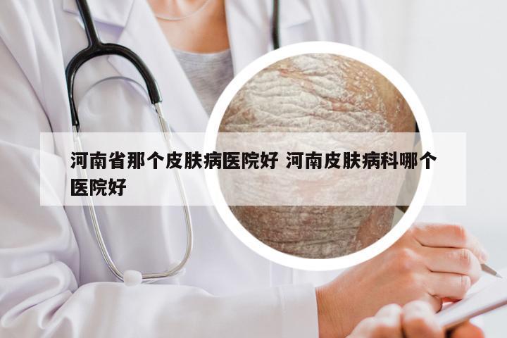 河南省那个皮肤病医院好 河南皮肤病科哪个医院好