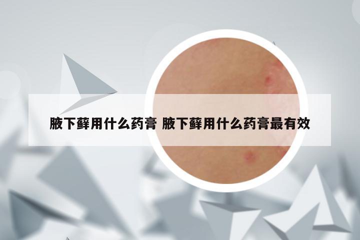 腋下藓用什么药膏 腋下藓用什么药膏最有效