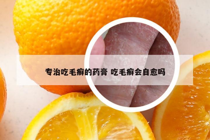 专治吃毛癣的药膏 吃毛癣会自愈吗