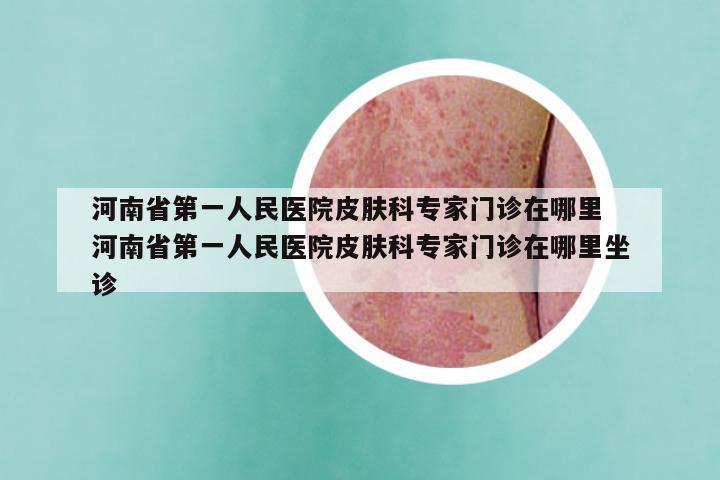 河南省第一人民医院皮肤科专家门诊在哪里 河南省第一人民医院皮肤科专家门诊在哪里坐诊