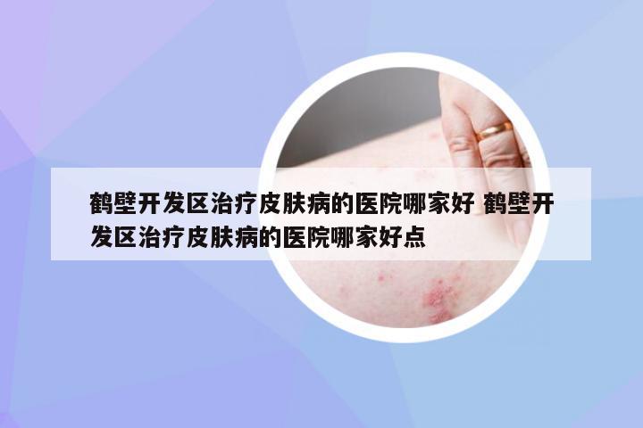 鹤壁开发区治疗皮肤病的医院哪家好 鹤壁开发区治疗皮肤病的医院哪家好点