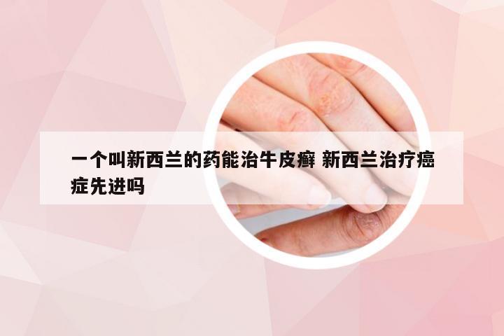 一个叫新西兰的药能治牛皮癣 新西兰治疗癌症先进吗