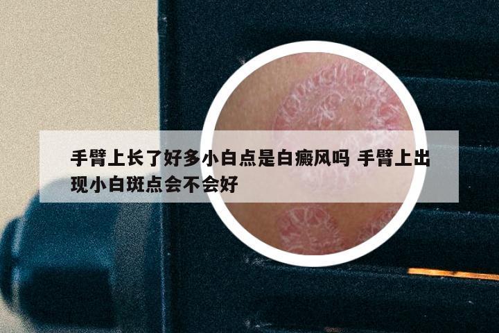 手臂上长了好多小白点是白癜风吗 手臂上出现小白斑点会不会好