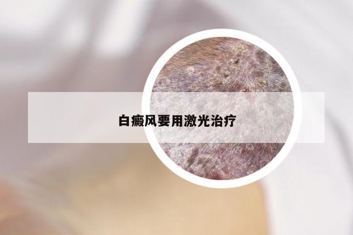 白癜风要用激光治疗