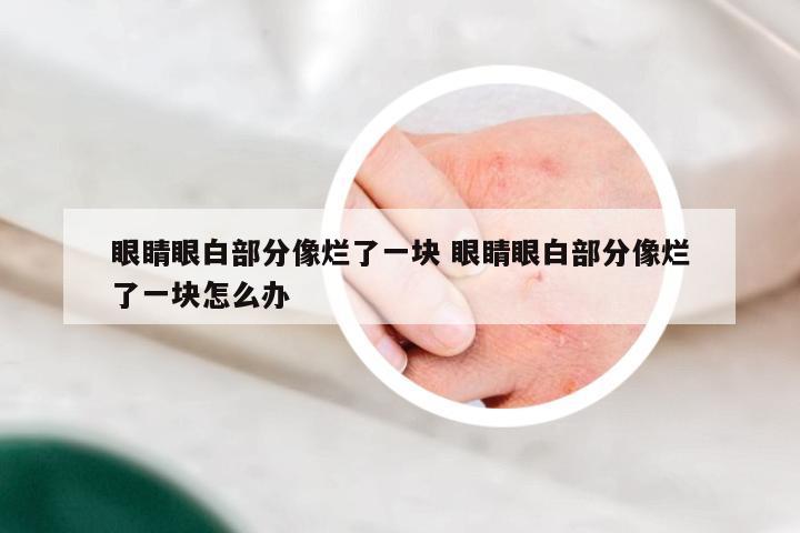 眼睛眼白部分像烂了一块 眼睛眼白部分像烂了一块怎么办