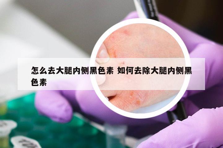 怎么去大腿内侧黑色素 如何去除大腿内侧黑色素