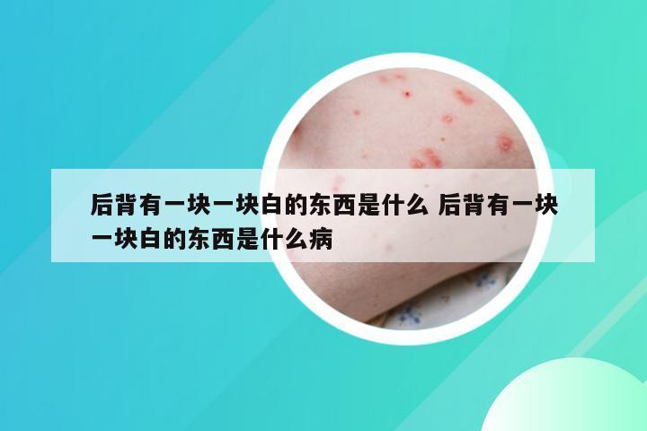 后背有一块一块白的东西是什么 后背有一块一块白的东西是什么病