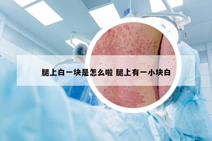 腿上白一块是怎么啦 腿上有一小块白