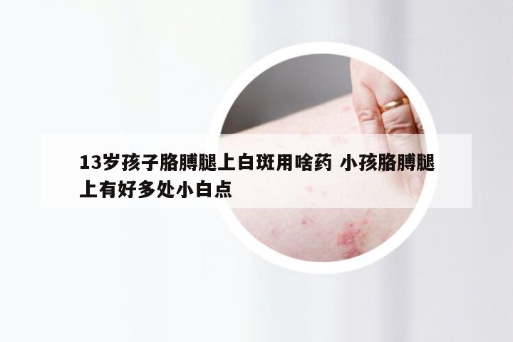 13岁孩子胳膊腿上白斑用啥药 小孩胳膊腿上有好多处小白点