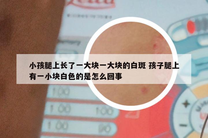 小孩腿上长了一大块一大块的白斑 孩子腿上有一小块白色的是怎么回事