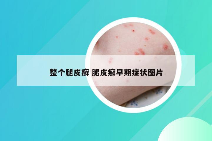 整个腿皮癣 腿皮癣早期症状图片