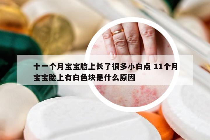 十一个月宝宝脸上长了很多小白点 11个月宝宝脸上有白色块是什么原因