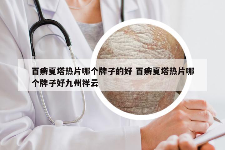 百癣夏塔热片哪个牌子的好 百癣夏塔热片哪个牌子好九州祥云