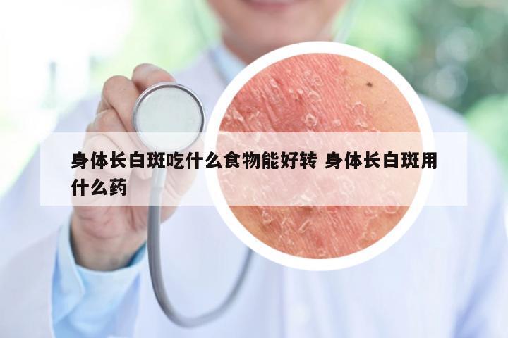 身体长白斑吃什么食物能好转 身体长白斑用什么药