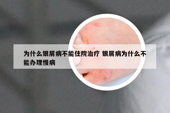 为什么银屑病不能住院治疗 银屑病为什么不能办理慢病