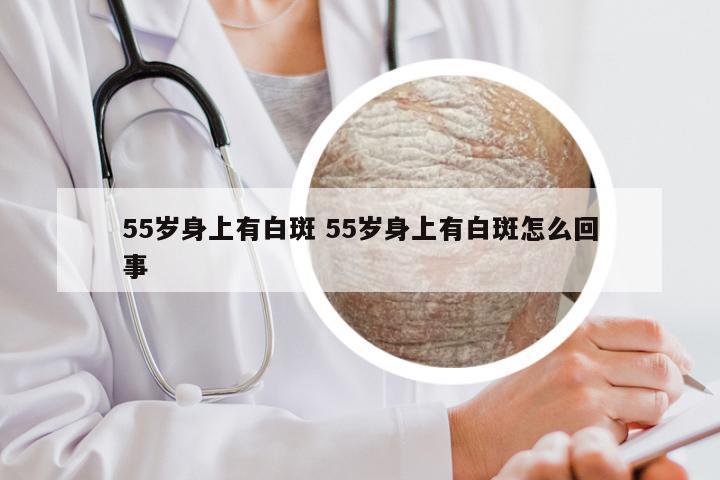 55岁身上有白斑 55岁身上有白斑怎么回事