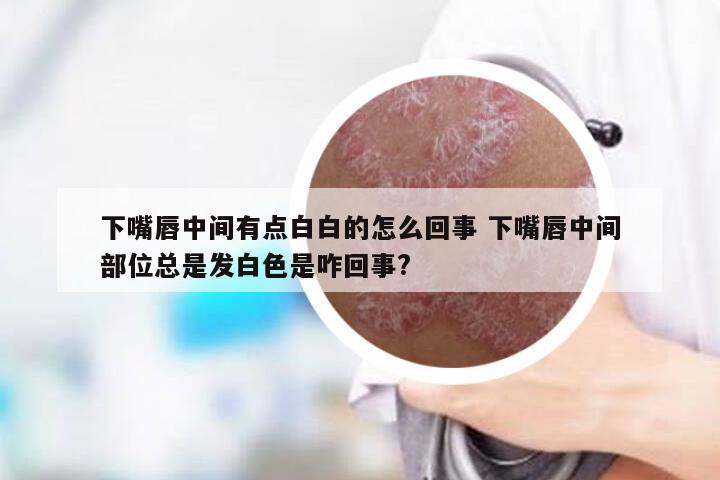 下嘴唇中间有点白白的怎么回事 下嘴唇中间部位总是发白色是咋回事?