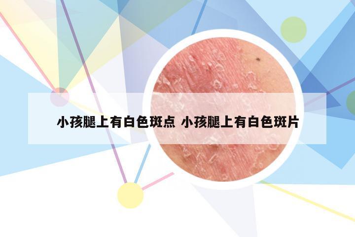 小孩腿上有白色斑点 小孩腿上有白色斑片