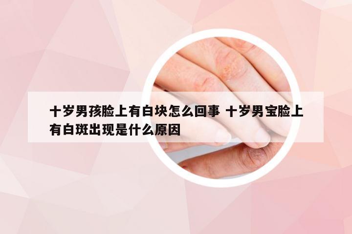 十岁男孩脸上有白块怎么回事 十岁男宝脸上有白斑出现是什么原因