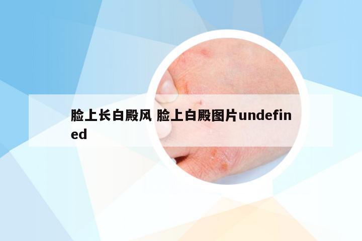 脸上长白殿风 脸上白殿图片undefined