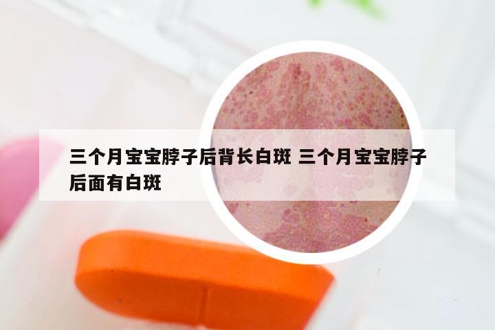 三个月宝宝脖子后背长白斑 三个月宝宝脖子后面有白斑