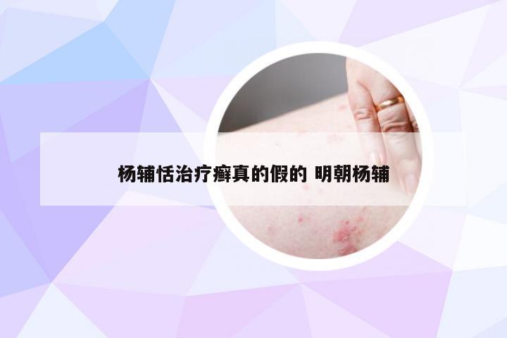 杨辅恬治疗癣真的假的 明朝杨辅