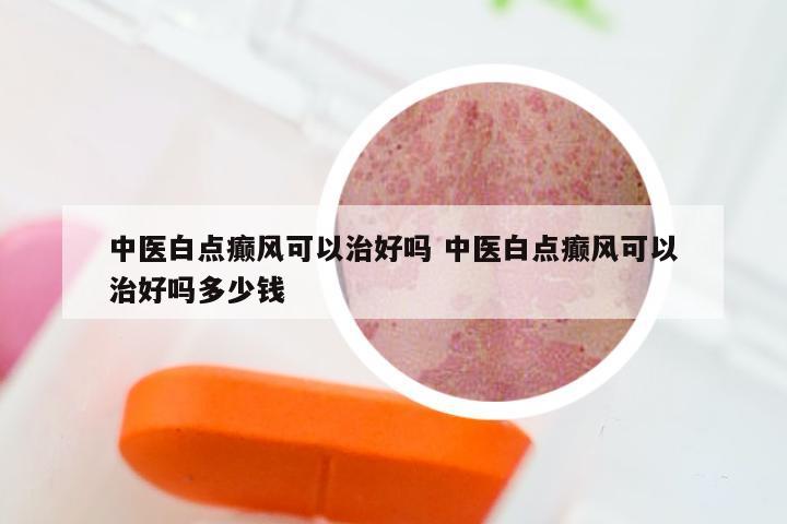 中医白点癫风可以治好吗 中医白点癫风可以治好吗多少钱