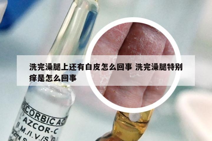 洗完澡腿上还有白皮怎么回事 洗完澡腿特别痒是怎么回事