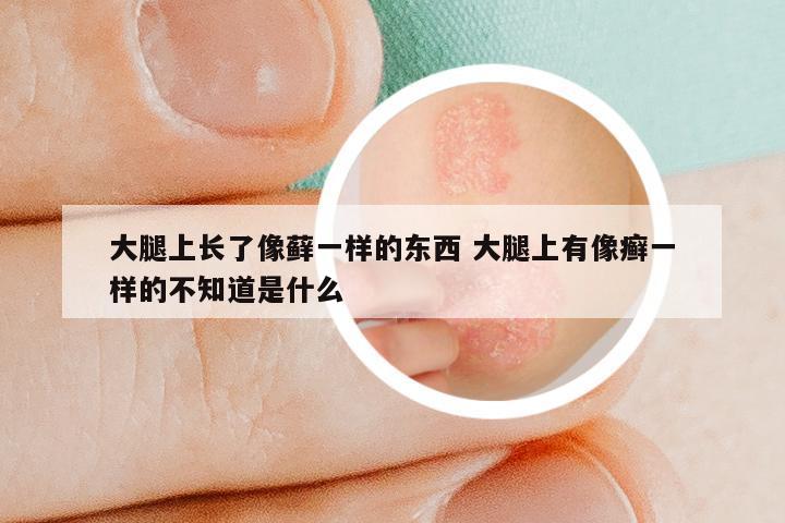 大腿上长了像藓一样的东西 大腿上有像癣一样的不知道是什么