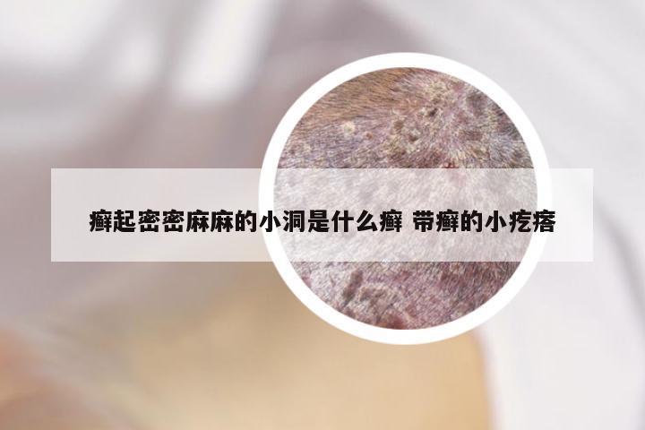 癣起密密麻麻的小洞是什么癣 带癣的小疙瘩