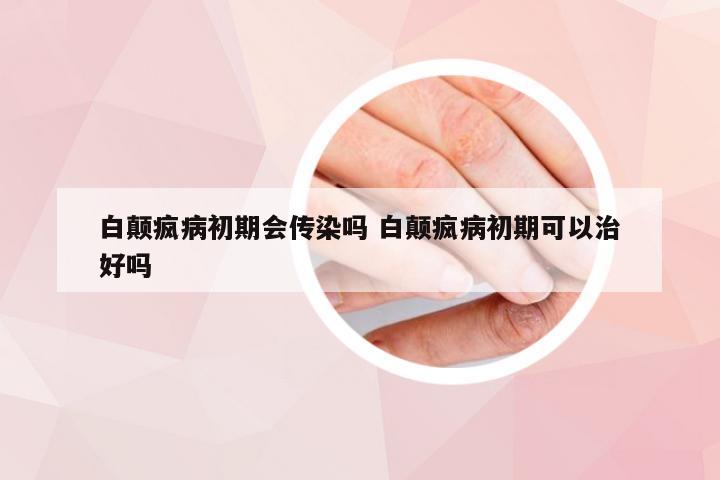 白颠疯病初期会传染吗 白颠疯病初期可以治好吗