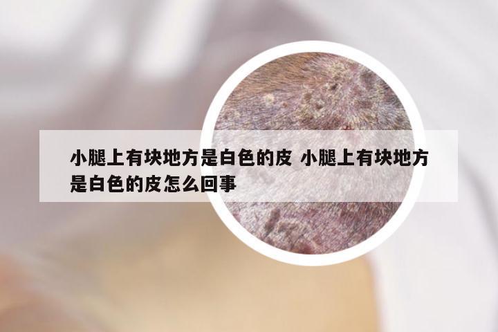 小腿上有块地方是白色的皮 小腿上有块地方是白色的皮怎么回事