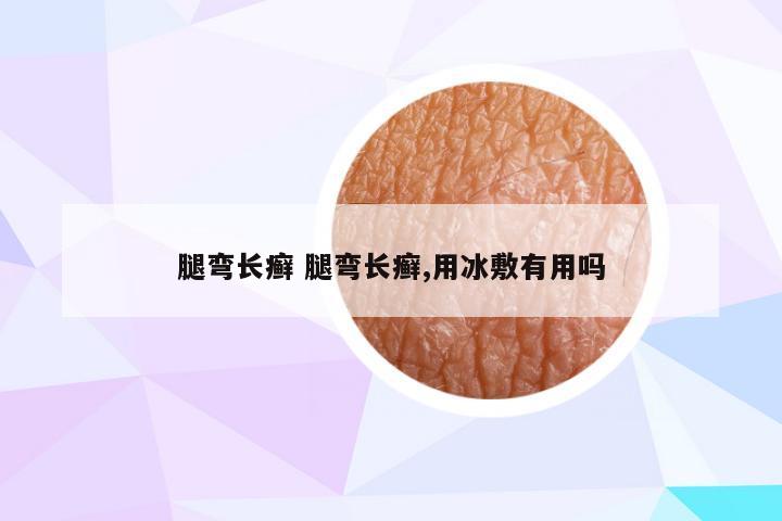 腿弯长癣 腿弯长癣,用冰敷有用吗